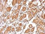 BCL2L12 Antibody in Immunohistochemistry (Paraffin) (IHC (P))