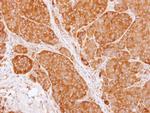 TCP-1 beta Antibody in Immunohistochemistry (Paraffin) (IHC (P))