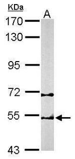 TCP-1 beta Antibody in Western Blot (WB)