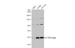 TCP-1 beta Antibody in Western Blot (WB)