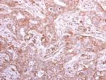 GMDS Antibody in Immunohistochemistry (Paraffin) (IHC (P))