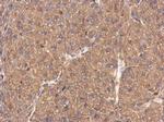 FMNL1 Antibody in Immunohistochemistry (Paraffin) (IHC (P))