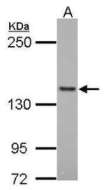 FMNL1 Antibody in Western Blot (WB)