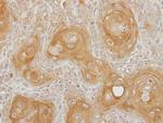 INPP5B Antibody in Immunohistochemistry (Paraffin) (IHC (P))