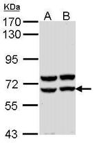 Pancreatic Amylase Antibody in Western Blot (WB)