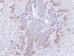 BTLA Antibody in Immunohistochemistry (Paraffin) (IHC (P))