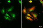 RPA2 Antibody in Immunocytochemistry (ICC/IF)