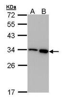 RPA2 Antibody in Western Blot (WB)