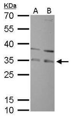 RPA2 Antibody in Western Blot (WB)