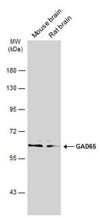 GAD65 Antibody in Western Blot (WB)