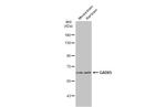 GAD65 Antibody in Western Blot (WB)