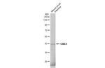 GNAS Antibody in Western Blot (WB)