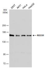 ROCK1 Antibody in Western Blot (WB)