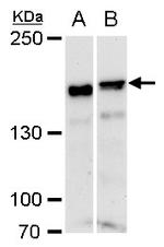 ROCK1 Antibody in Western Blot (WB)