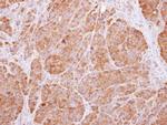 14-3-3 beta Antibody in Immunohistochemistry (Paraffin) (IHC (P))