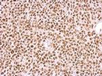 BCCIP Antibody in Immunohistochemistry (Paraffin) (IHC (P))