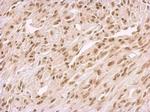 BCCIP Antibody in Immunohistochemistry (Paraffin) (IHC (P))