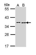 BCCIP Antibody in Western Blot (WB)