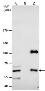 CBS Antibody in Immunoprecipitation (IP)