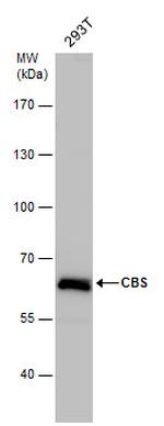 CBS Antibody in Western Blot (WB)