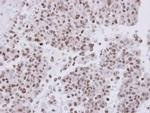 FANCA Antibody in Immunohistochemistry (Paraffin) (IHC (P))