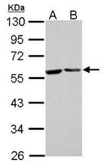 FKBP4 Antibody in Western Blot (WB)