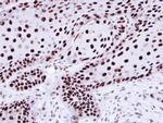 hnRNP C Antibody in Immunohistochemistry (Paraffin) (IHC (P))