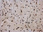 hnRNP C Antibody in Immunohistochemistry (Paraffin) (IHC (P))