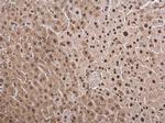 PSMB8 Antibody in Immunohistochemistry (Paraffin) (IHC (P))