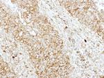 SH3GL1 Antibody in Immunohistochemistry (Paraffin) (IHC (P))