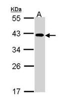 eIF2b beta Antibody in Western Blot (WB)