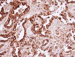 MVP Antibody in Immunohistochemistry (Paraffin) (IHC (P))