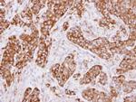 MVP Antibody in Immunohistochemistry (Paraffin) (IHC (P))