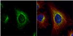 ASL Antibody in Immunocytochemistry (ICC/IF)