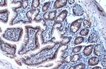 HNF1A Antibody in Immunohistochemistry (Paraffin) (IHC (P))