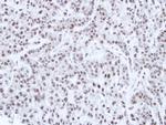 HNF1A Antibody in Immunohistochemistry (Paraffin) (IHC (P))