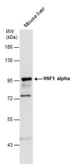 HNF1A Antibody in Western Blot (WB)