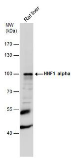 HNF1A Antibody in Western Blot (WB)