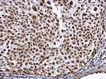 ALY Antibody in Immunohistochemistry (Paraffin) (IHC (P))