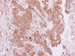 PIM2 Antibody in Immunohistochemistry (Paraffin) (IHC (P))