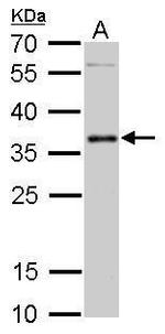 PIM2 Antibody in Western Blot (WB)