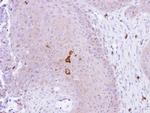 PADI4 Antibody in Immunohistochemistry (Paraffin) (IHC (P))