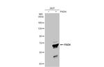 PADI4 Antibody in Western Blot (WB)