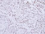 RAD18 Antibody in Immunohistochemistry (Paraffin) (IHC (P))