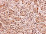 NAT2 Antibody in Immunohistochemistry (Paraffin) (IHC (P))