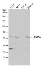 UGT1A9 Antibody in Western Blot (WB)