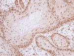 Livin Antibody in Immunohistochemistry (Paraffin) (IHC (P))