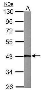 Arylsulfatase A Antibody in Western Blot (WB)