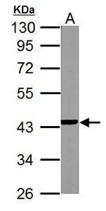 NDUFA10 Antibody in Western Blot (WB)