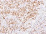 PABPC3 Antibody in Immunohistochemistry (Paraffin) (IHC (P))